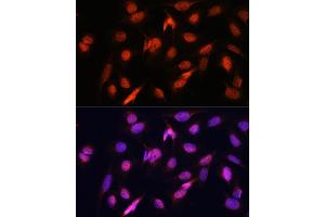 Immunofluorescence analysis of U2OS cells using OTUB1 antibody (ABIN6128400, ABIN6145086, ABIN6145088 and ABIN6215346) at dilution of 1:100.