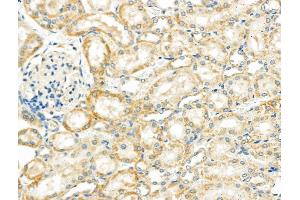 ABIN6257368 and ABIN6275745 at 1/100 staining Rat kidney tissue by IHC-P. (NDFIP1 anticorps  (C-Term))