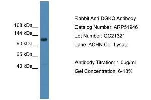 WB Suggested Anti-DGKQ  Antibody Titration: 0. (DGKQ anticorps  (Middle Region))