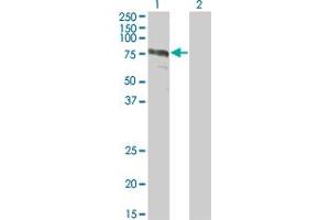 Western Blot analysis of ZYX expression in transfected 293T cell line by ZYX monoclonal antibody (M01), clone 2C10-4A7. (ZYX anticorps  (AA 1-572))