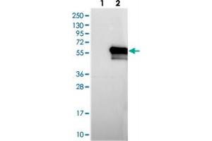 Western blot analysis of Lane 1: Negative control (vector only transfected HEK293T lysate), Lane 2: Over-expression Lysate (Co-expressed with a C-terminal myc-DDK tag (~3. (KIAA1609 anticorps)