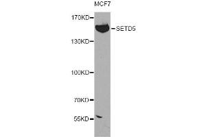Western blot analysis of extracts of MCF-7 cells, using SETD5 antibody (ABIN4905135) at 1:300 dilution. (SETD5 anticorps)