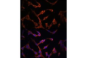 Immunofluorescence analysis of NIH/3T3 cells using HLA-DPB1 antibody (ABIN7268370) at dilution of 1:100. (HLA-DPB1 anticorps)