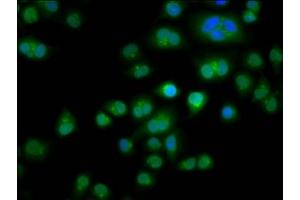Immunofluorescence staining of Hela cells with ABIN7171794 at 1:266, counter-stained with DAPI. (TES anticorps  (AA 130-260))