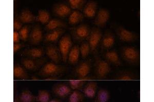 Immunofluorescence analysis of HeLa cells using IPO8 Polyclonal Antibody at dilution of 1:100.
