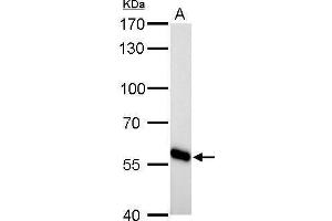 WB Image CYP27A1 antibody detects CYP27A1 protein by Western blot analysis.