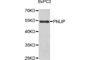 Western blot analysis of extracts of BxPC-3 cells, using PNLIP antibody (ABIN5975718) at 1/1000 dilution. (PNLIP anticorps)