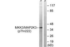Western blot analysis of extracts from Jurkat cells treated with serum 20% 15', using MAP2K3 (Phospho-Thr222) Antibody. (MAP2K3 anticorps  (pThr222))