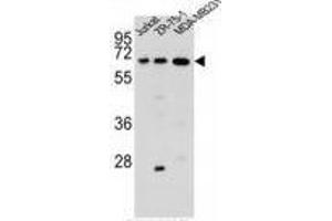 ZSCAN2 Antibody (N-term) western blot analysis in Jurkat,ZR-75-1, MDA-MB231 cell line lysates (35 µg/lane).
