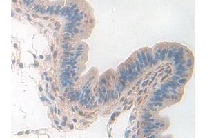 Detection of PDXK in Mouse Uterus Tissue using Polyclonal Antibody to Pyridoxal Kinase (PDXK)