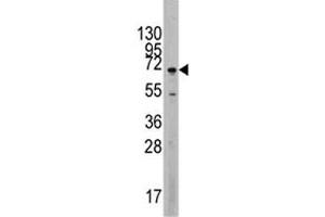 Western blot analysis of MAPK4 antibody and Jurkat lysate.