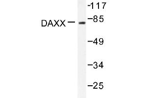 Image no. 1 for anti-Death-Domain Associated Protein (DAXX) antibody (ABIN271883) (DAXX anticorps)