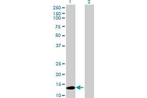 Western Blot analysis of MED22 expression in transfected 293T cell line by MED22 MaxPab polyclonal antibody. (MED22 anticorps  (AA 1-140))