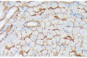Immunohistochemistry of paraffin-embedded Mouse kidney using IFITM1 Polyclonal Antibody at dilution of 1:100 (40x lens). (IFITM1 anticorps)