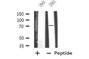 Western blot analysis of extracts from 293 cells, using IRAK2 antibody.