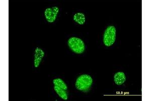 Immunofluorescence of monoclonal antibody to NFATC3 on HeLa cell.