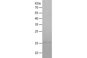 Interleukin 4 (IL4) (AA 25-153) (Active) protein (His tag)