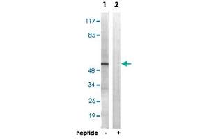 Western blot analysis of extracts from HT-29 cells, using APLF polyclonal antibody . (APLF anticorps  (Ser116))