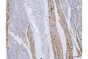 IHC analysis of CD35 using anti-CD35 antibody (ABIN7599703).