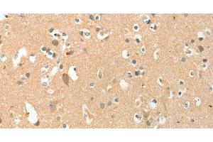 Immunohistochemistry of paraffin-embedded Human brain tissue using AANAT Polyclonal Antibody at dilution 1:40 (AANAT anticorps)
