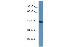 Western Blot showing PRPF38A antibody used at a concentration of 1-2 ug/ml to detect its target protein.