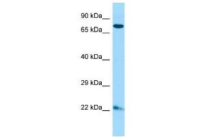 Host:  Rabbit  Target Name:  Zfp74  Sample Type:  Mouse Lung lysates  Antibody Dilution:  1. (ZNF74 anticorps  (C-Term))