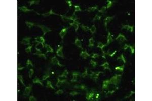 Immunofluorescence analysis of CA9 antibody with HeLa cells.