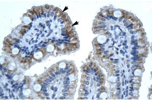 Human Intestine (GJB1 anticorps  (C-Term))