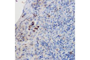 Immunohistochemistry of paraffin-embedded human tonsil using IL17A Rabbit pAb (ABIN6128129, ABIN6142315, ABIN6142317 and ABIN6216088) at dilution of 1:200 (40x lens). (Interleukin 17a anticorps  (AA 24-155))