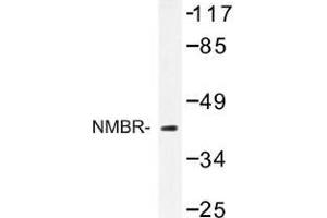 Image no. 1 for anti-Neuromedin B Receptor (NMBR) antibody (ABIN317709) (NMBR anticorps)