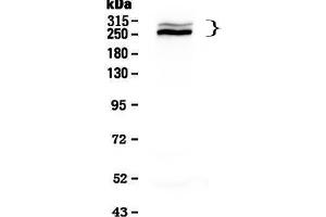Western blot analysis of Desmoplakin using anti-Desmoplakin antibody . (Desmoplakin anticorps  (AA 1810-2092))