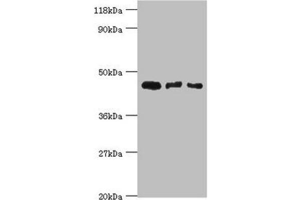Calreticulin 3 anticorps  (AA 135-384)