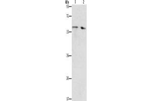 Gel: 10 % SDS-PAGE, Lysate: 40 μg, Lane 1-2: Human liver cancer tissue, Human fetal liver tissue, Primary antibody: ABIN7192673(STEAP4 Antibody) at dilution 1/450, Secondary antibody: Goat anti rabbit IgG at 1/8000 dilution, Exposure time: 40 seconds