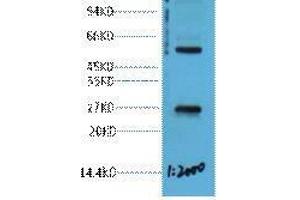 Western Blot (WB) analysis of 293T cell lysate, diluted at 1:2000.