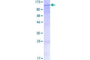 Image no. 1 for Mediator Complex Subunit 15 (MED15) (AA 1-674) protein (GST tag) (ABIN1310634)