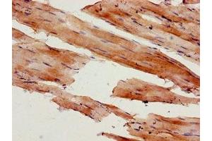 Immunohistochemistry of paraffin-embedded human skeletal muscle tissue using ABIN7160555 at dilution of 1:100 (MYL9 anticorps  (AA 2-172))
