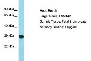 Host: Rabbit Target Name: LSM14B Sample Type: Fetal Brain lysates Antibody Dilution: 1. (LSM14B anticorps  (N-Term))