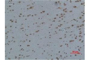 Immunohistochemistry (IHC) analysis of paraffin-embedded Rat Brain Tissue using L-type Ca++ CP gamma4 Polyclonal Antibody.