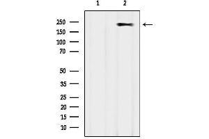 anti-Myosin Heavy Chain 2, Skeletal Muscle, Adult (MYH2) antibody