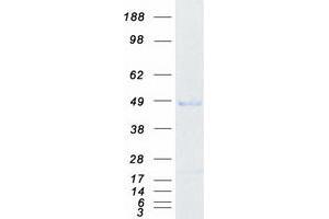 Validation with Western Blot