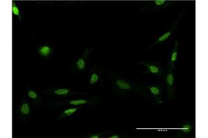 Immunofluorescence of monoclonal antibody to FASTK on HeLa cell. (FASTK anticorps  (AA 67-154))