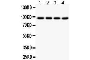 Anti- SLC6A4 Picoband antibody, Western blotting All lanes: Anti SLC6A4  at 0.