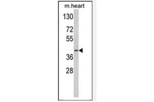 Image no. 3 for anti-Medium-Chain Specific Acyl-CoA Dehydrogenase, Mitochondrial (MCAD) (AA 196-225) antibody (ABIN452704) (Medium-Chain Specific Acyl-CoA Dehydrogenase, Mitochondrial (MCAD) (AA 196-225) anticorps)