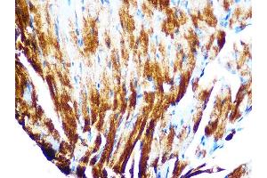 Immunohistochemistry of paraffin-embedded mouse heart using Cardiac Cardiac troponin T (TNNT2) (TNNT2) Rabbit mAb (ABIN7266088) at dilution of 1:100 (40x lens).