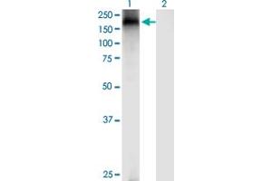 Western Blot analysis of TRPA1 expression in transfected 293T cell line by TRPA1 monoclonal antibody (M03), clone 6G8.