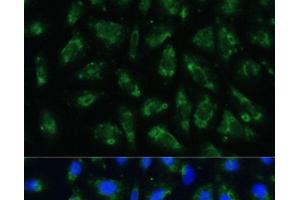 Immunofluorescence analysis of U-2 OS cells using APOB Polyclonal Antibody at dilution of 1:100.