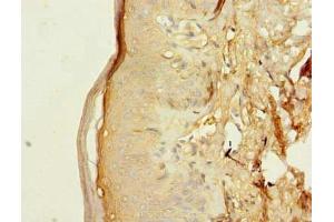 Immunohistochemistry of paraffin-embedded human skin tissue using ABIN7173099 at dilution of 1:100