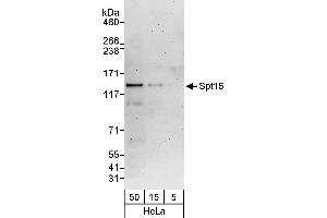 Western Blotting (WB) image for anti-FACT complex subunit SPT16 (SUPT16H) (AA 997-1047) antibody (ABIN7453210)