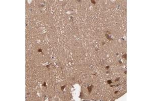 Immunohistochemical staining of human cerebral cortex with STAP2 polyclonal antibody  shows strong cytoplasmic positivity in neuronal cells. (STAP2 anticorps)