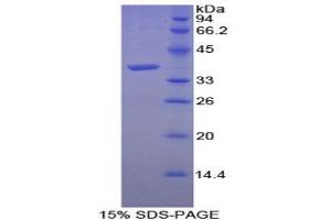 SDS-PAGE analysis of Human Calcineurin Protein. (CAN Protéine)
